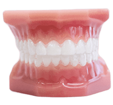Clear Aligners